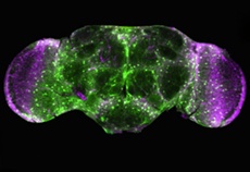The brain of a fruit fly used to study neurodegenerative diseases